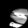 SPORK, NICO - 22.03.1976 - 02.08.2022 - CT obere Extremität - 17:51:17